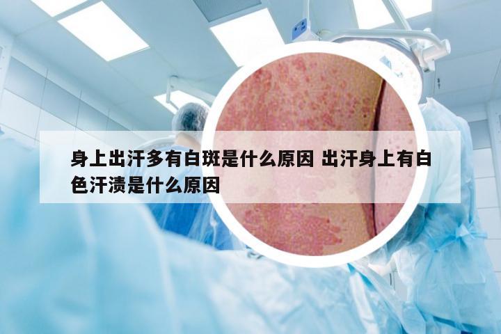 身上出汗多有白斑是什么原因 出汗身上有白色汗渍是什么原因