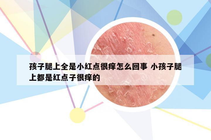 孩子腿上全是小红点很痒怎么回事 小孩子腿上都是红点子很痒的