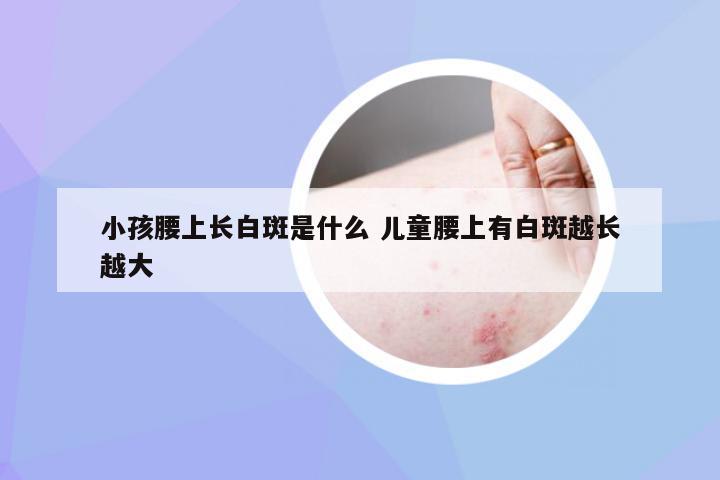 小孩腰上长白斑是什么 儿童腰上有白斑越长越大