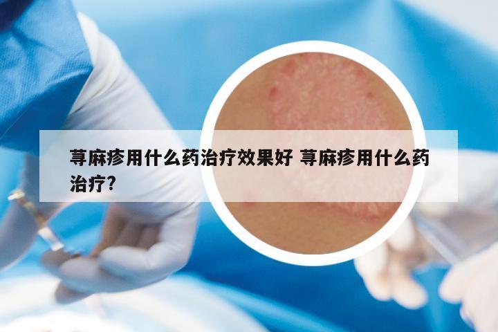 荨麻疹用什么药治疗效果好 荨麻疹用什么药治疗?