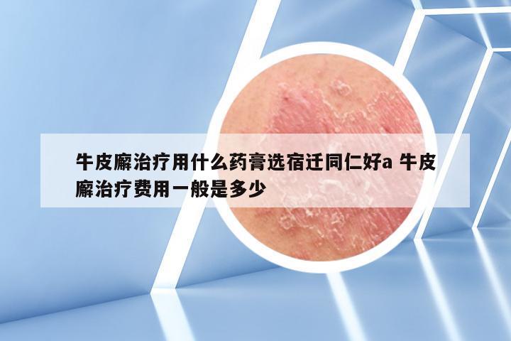 牛皮廨治疗用什么药膏选宿迁同仁好a 牛皮廨治疗费用一般是多少