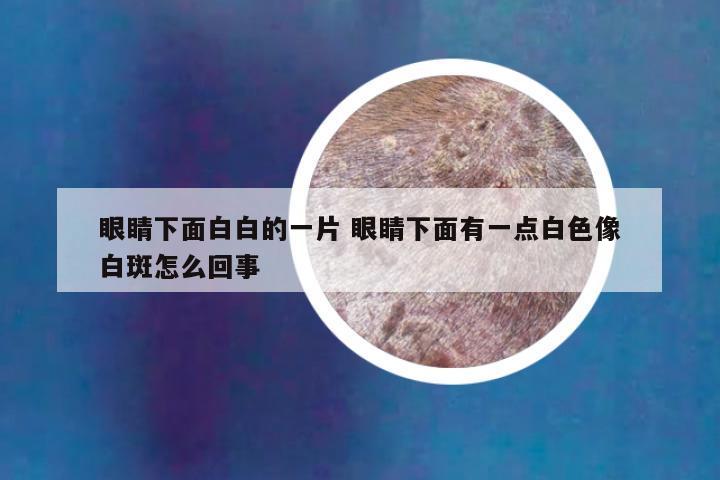 眼睛下面白白的一片 眼睛下面有一点白色像白斑怎么回事