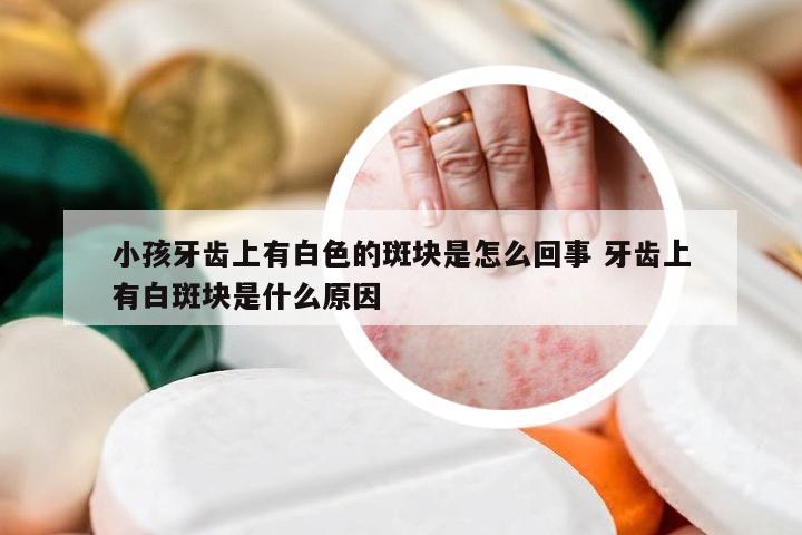 小孩牙齿上有白色的斑块是怎么回事 牙齿上有白斑块是什么原因