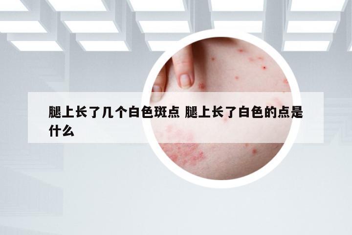 腿上长了几个白色斑点 腿上长了白色的点是什么