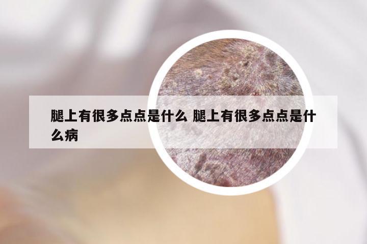 腿上有很多点点是什么 腿上有很多点点是什么病