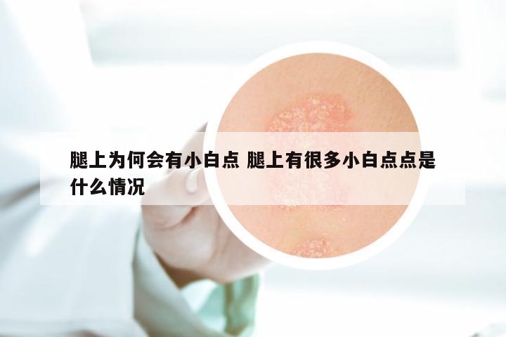 腿上为何会有小白点 腿上有很多小白点点是什么情况