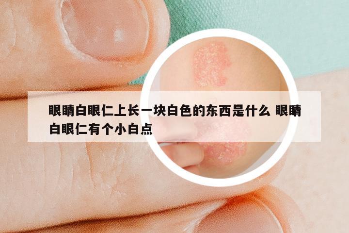 眼睛白眼仁上长一块白色的东西是什么 眼睛白眼仁有个小白点