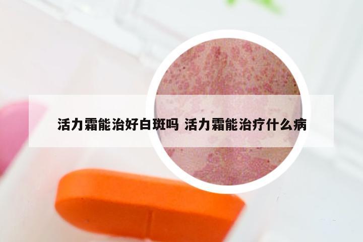 活力霜能治好白斑吗 活力霜能治疗什么病