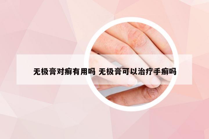 无极膏对癣有用吗 无极膏可以治疗手癣吗