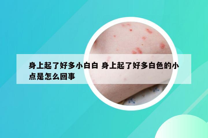 身上起了好多小白白 身上起了好多白色的小点是怎么回事