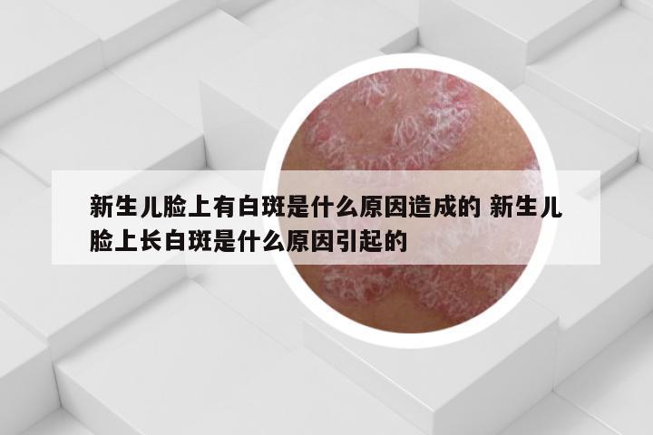 新生儿脸上有白斑是什么原因造成的 新生儿脸上长白斑是什么原因引起的