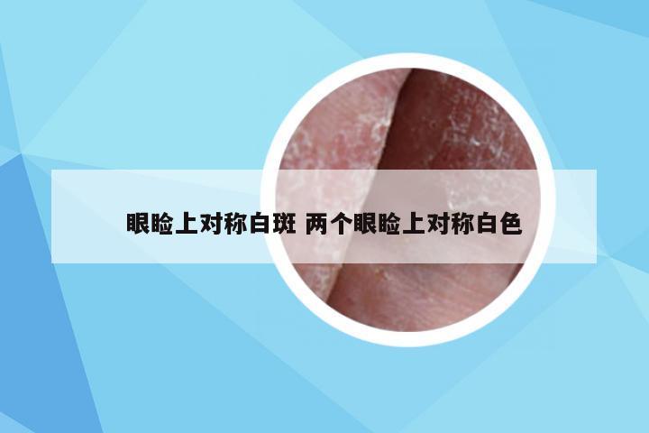 眼睑上对称白斑 两个眼睑上对称白色