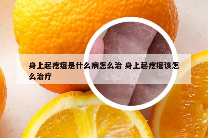 身上起疙瘩是什么病怎么治 身上起疙瘩该怎么治疗