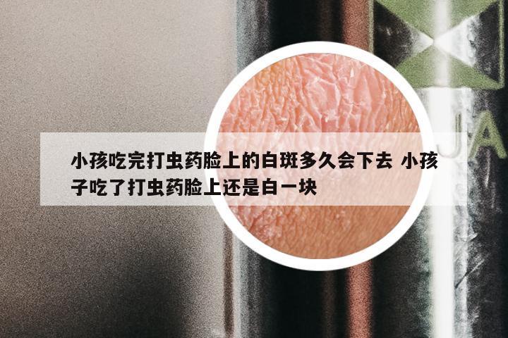 小孩吃完打虫药脸上的白斑多久会下去 小孩子吃了打虫药脸上还是白一块