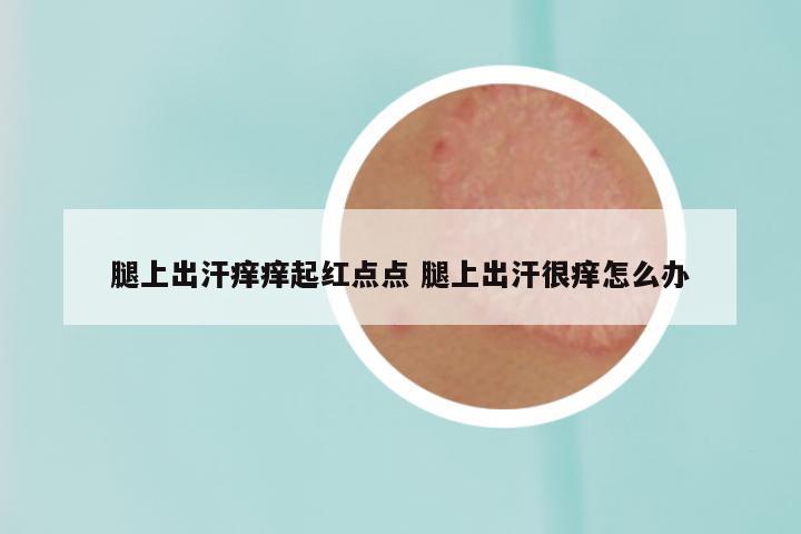 腿上出汗痒痒起红点点 腿上出汗很痒怎么办