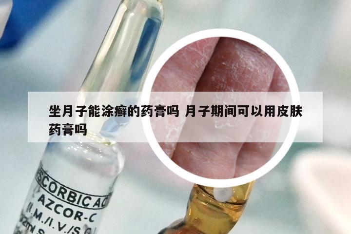 坐月子能涂癣的药膏吗 月子期间可以用皮肤药膏吗