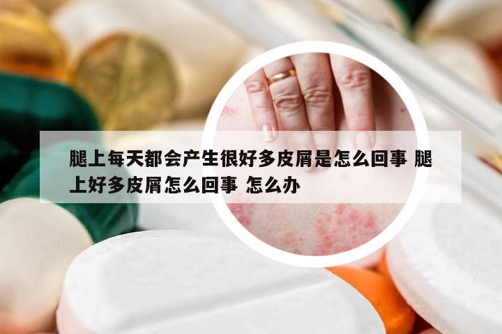 腿上每天都会产生很好多皮屑是怎么回事 腿上好多皮屑怎么回事 怎么办