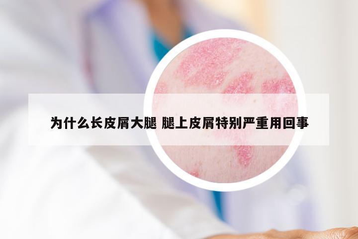 为什么长皮屑大腿 腿上皮屑特别严重用回事