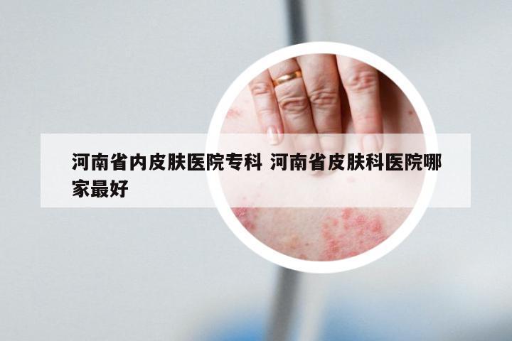 河南省内皮肤医院专科 河南省皮肤科医院哪家最好