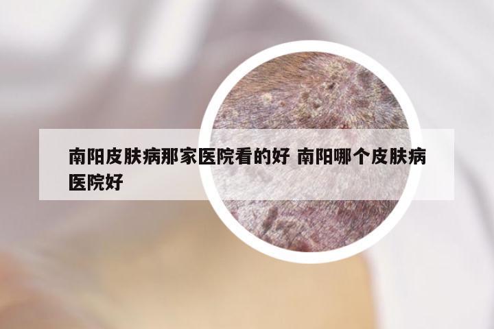 南阳皮肤病那家医院看的好 南阳哪个皮肤病医院好