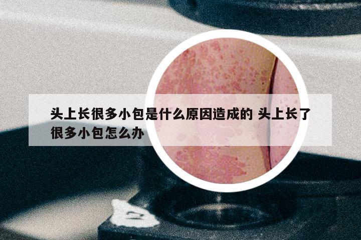 头上长很多小包是什么原因造成的 头上长了很多小包怎么办