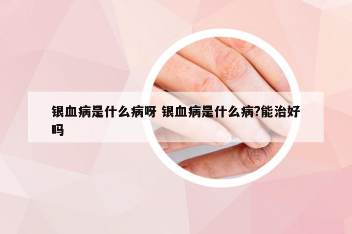 银血病是什么病呀 银血病是什么病?能治好吗