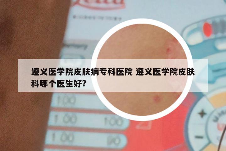 遵义医学院皮肤病专科医院 遵义医学院皮肤科哪个医生好?