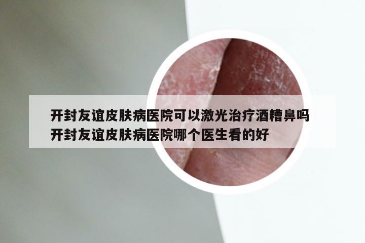 开封友谊皮肤病医院可以激光治疗酒糟鼻吗 开封友谊皮肤病医院哪个医生看的好