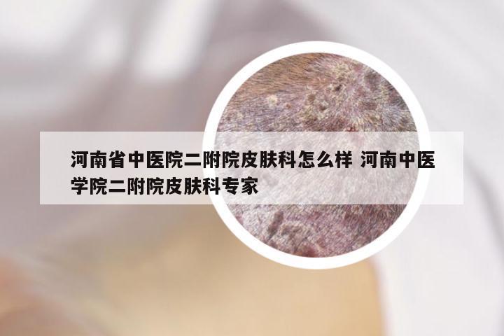 河南省中医院二附院皮肤科怎么样 河南中医学院二附院皮肤科专家