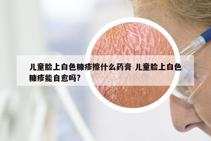 儿童脸上白色糠疹擦什么药膏 儿童脸上白色糠疹能自愈吗?