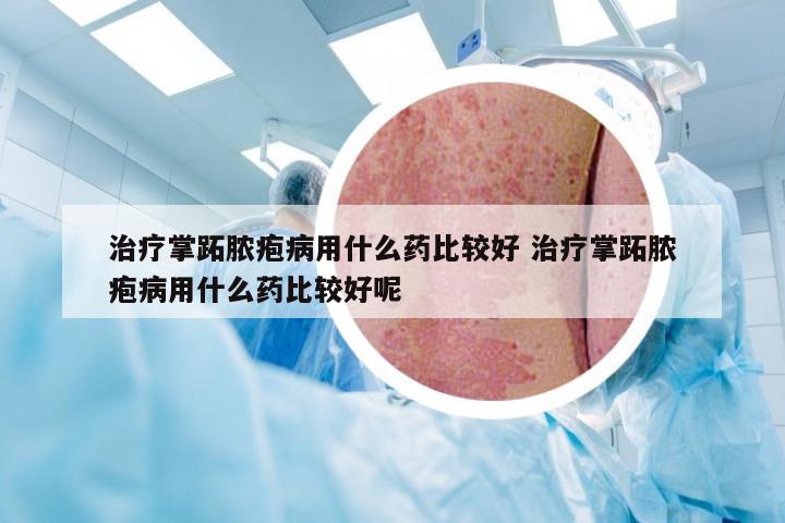 治疗掌跖脓疱病用什么药比较好 治疗掌跖脓疱病用什么药比较好呢