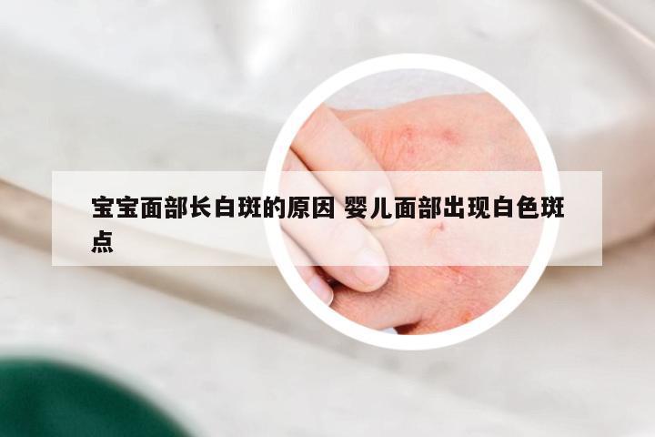 宝宝面部长白斑的原因 婴儿面部出现白色斑点