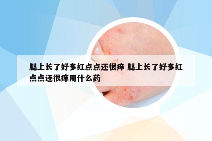 腿上长了好多红点点还很痒 腿上长了好多红点点还很痒用什么药