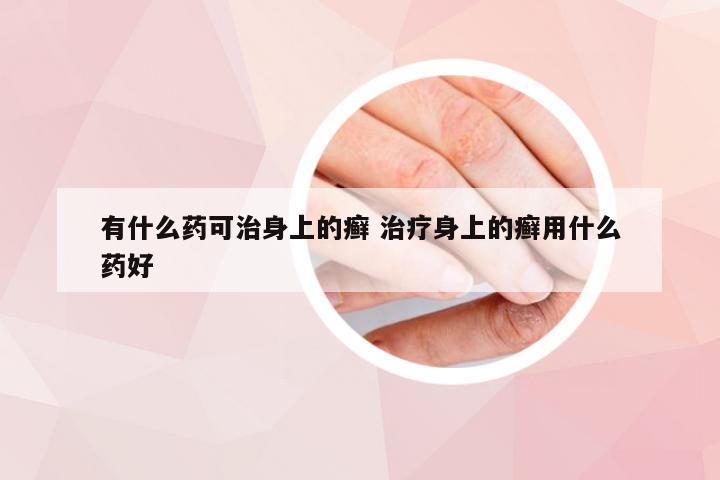 有什么药可治身上的癣 治疗身上的癣用什么药好