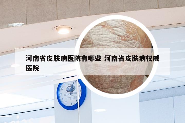 河南省皮肤病医院有哪些 河南省皮肤病权威医院