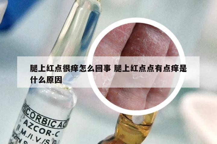 腿上红点很痒怎么回事 腿上红点点有点痒是什么原因