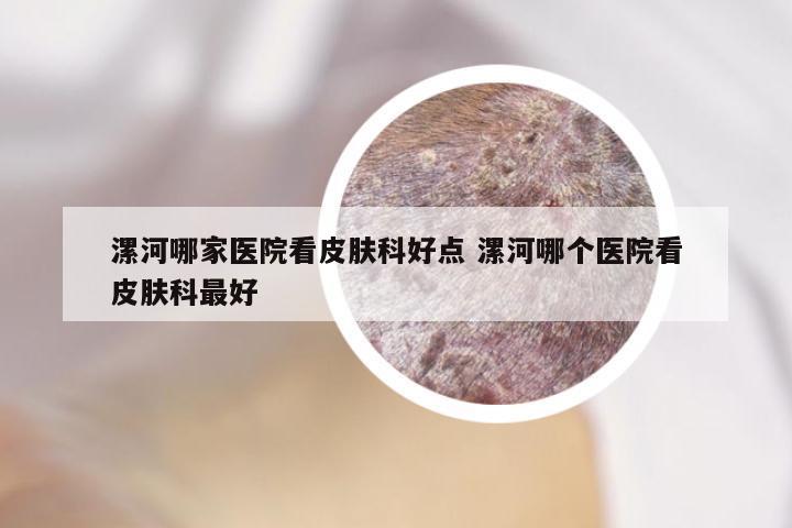 漯河哪家医院看皮肤科好点 漯河哪个医院看皮肤科最好