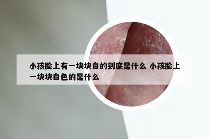 小孩脸上有一块块白的到底是什么 小孩脸上一块块白色的是什么