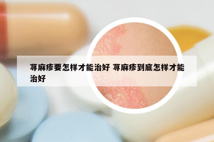 荨麻疹要怎样才能治好 荨麻疹到底怎样才能治好