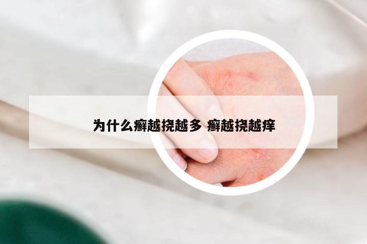 为什么癣越挠越多 癣越挠越痒