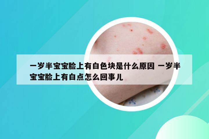 一岁半宝宝脸上有白色块是什么原因 一岁半宝宝脸上有白点怎么回事儿