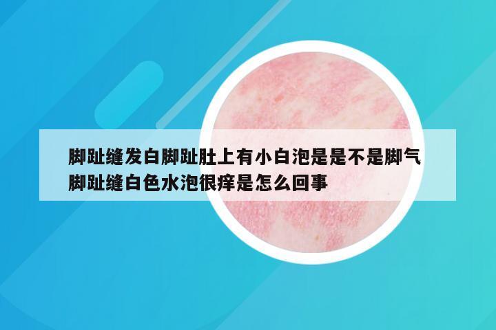 脚趾缝发白脚趾肚上有小白泡是是不是脚气 脚趾缝白色水泡很痒是怎么回事