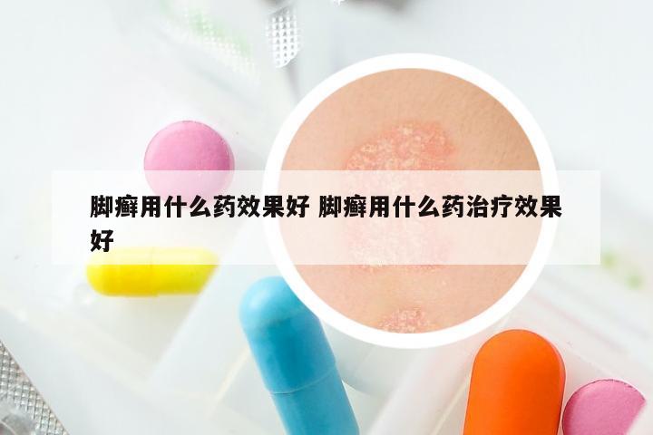 脚癣用什么药效果好 脚癣用什么药治疗效果好