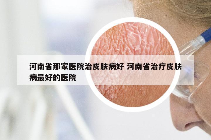 河南省那家医院治皮肤病好 河南省治疗皮肤病最好的医院