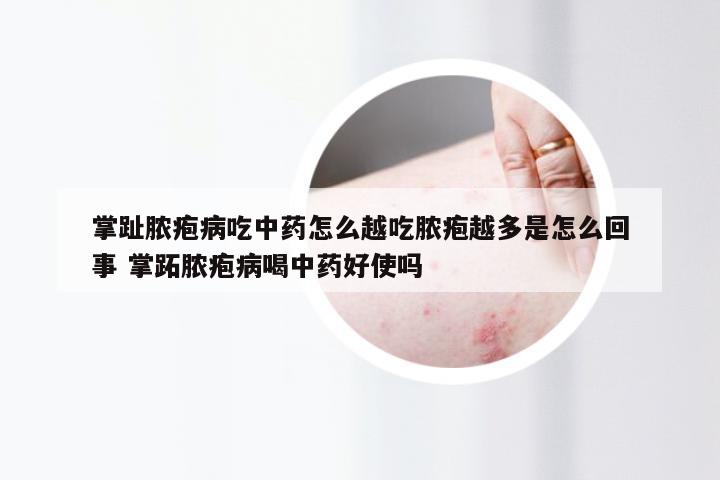 掌趾脓疱病吃中药怎么越吃脓疱越多是怎么回事 掌跖脓疱病喝中药好使吗