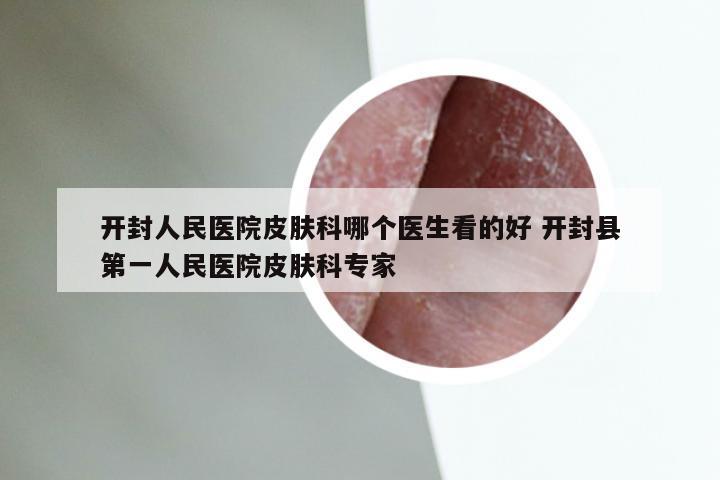 开封人民医院皮肤科哪个医生看的好 开封县第一人民医院皮肤科专家