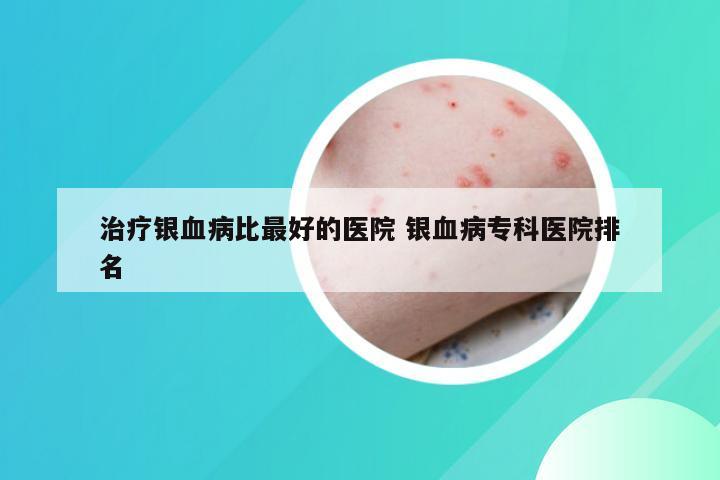 治疗银血病比最好的医院 银血病专科医院排名