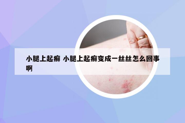 小腿上起癣 小腿上起癣变成一丝丝怎么回事啊