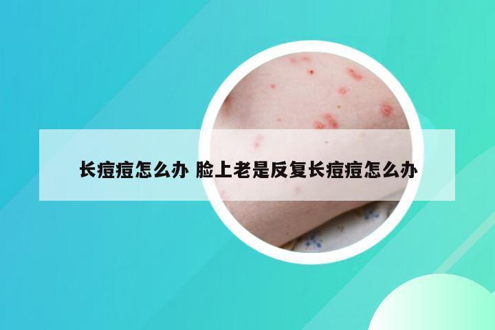 长痘痘怎么办 脸上老是反复长痘痘怎么办