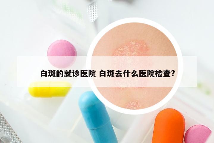 白斑的就诊医院 白斑去什么医院检查?